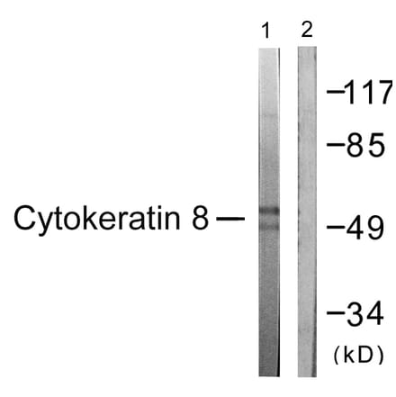 Western Blot - Anti-Keratin 8 Antibody (B0883) - Antibodies.com