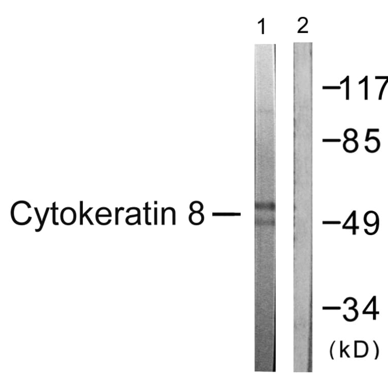 Western Blot - Anti-Keratin 8 Antibody (B0883) - Antibodies.com