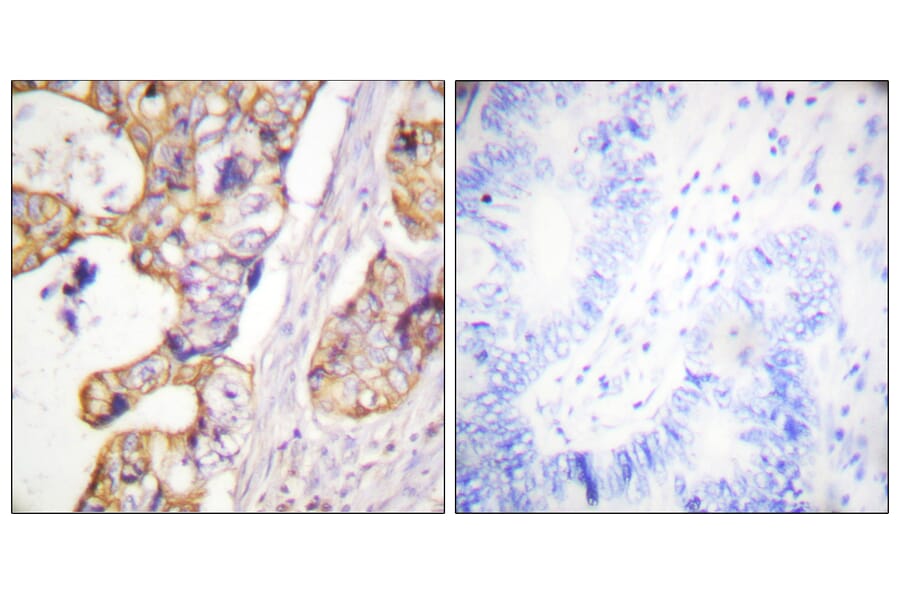 Immunohistochemistry - Anti-Keratin 8 Antibody (B0883) - Antibodies.com