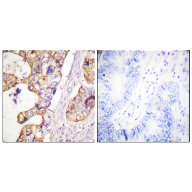 Immunohistochemistry - Anti-Keratin 8 Antibody (B0883) - Antibodies.com