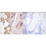 Immunohistochemistry - Anti-Keratin 8 Antibody (B0883) - Antibodies.com