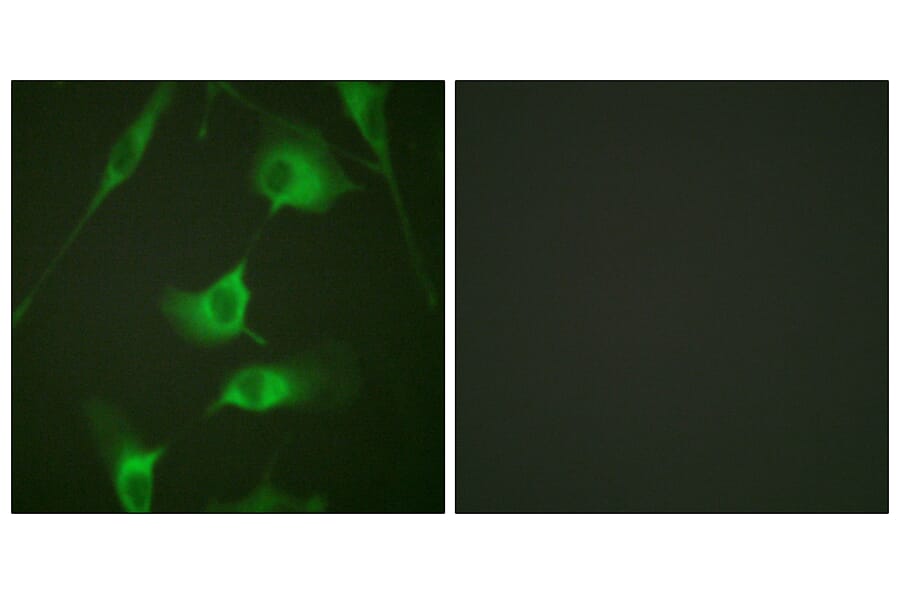 Immunofluorescence - Anti-Keratin 8 Antibody (B0883) - Antibodies.com