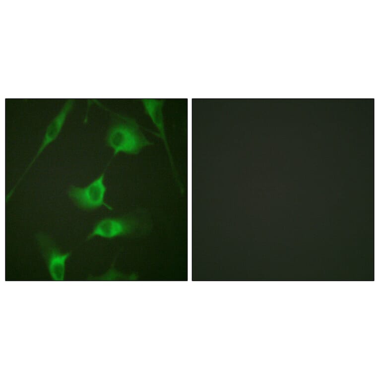 Immunofluorescence - Anti-Keratin 8 Antibody (B0883) - Antibodies.com