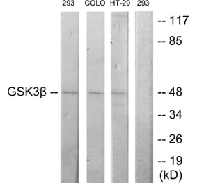 Western Blot - Anti-GSK3 beta Antibody (B7098) - Antibodies.com