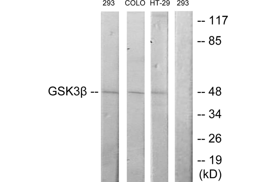 Western Blot - Anti-GSK3 beta Antibody (B7098) - Antibodies.com