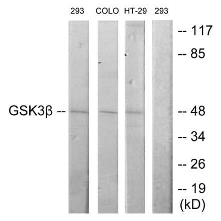 Western Blot - Anti-GSK3 beta Antibody (B7098) - Antibodies.com