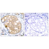 Immunohistochemistry - Anti-GSK3 beta Antibody (B7098) - Antibodies.com