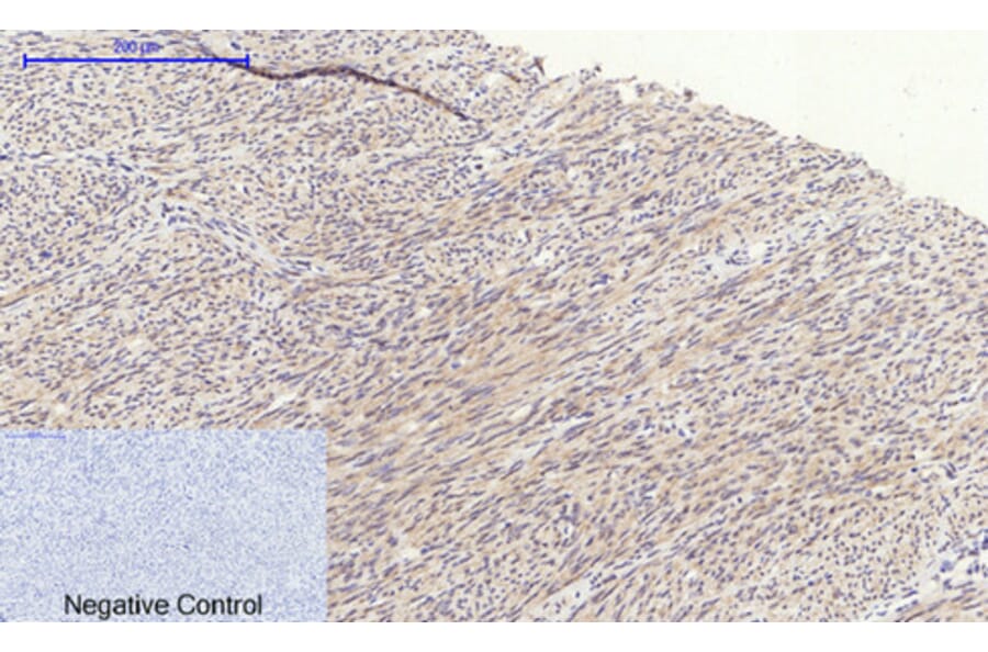Immunohistochemistry - Anti-GSK3 beta Antibody (B7098) - Antibodies.com