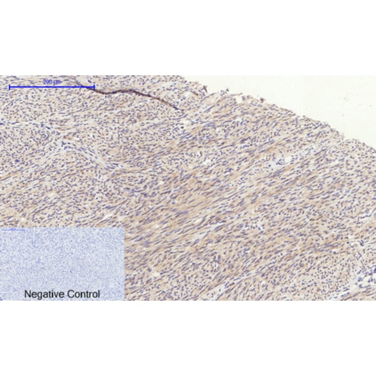 Immunohistochemistry - Anti-GSK3 beta Antibody (B7098) - Antibodies.com