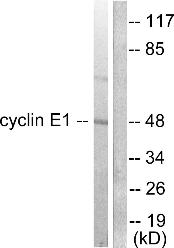 Anti-Cyclin E1 Antibody (A94771) | Antibodies.com