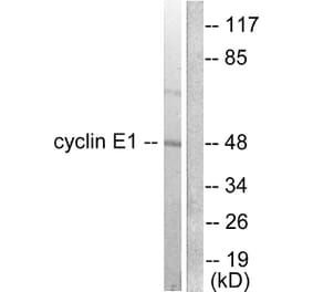 Western Blot - Anti-Cyclin E1 Antibody (C0167) - Antibodies.com