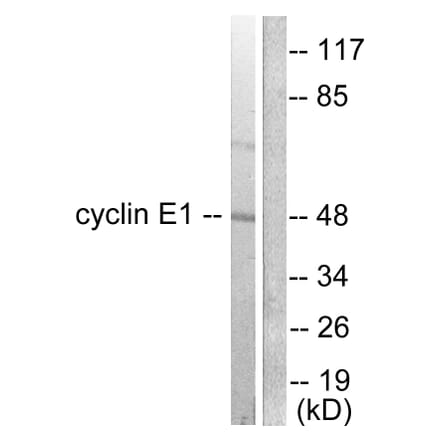 Western Blot - Anti-Cyclin E1 Antibody (C0167) - Antibodies.com
