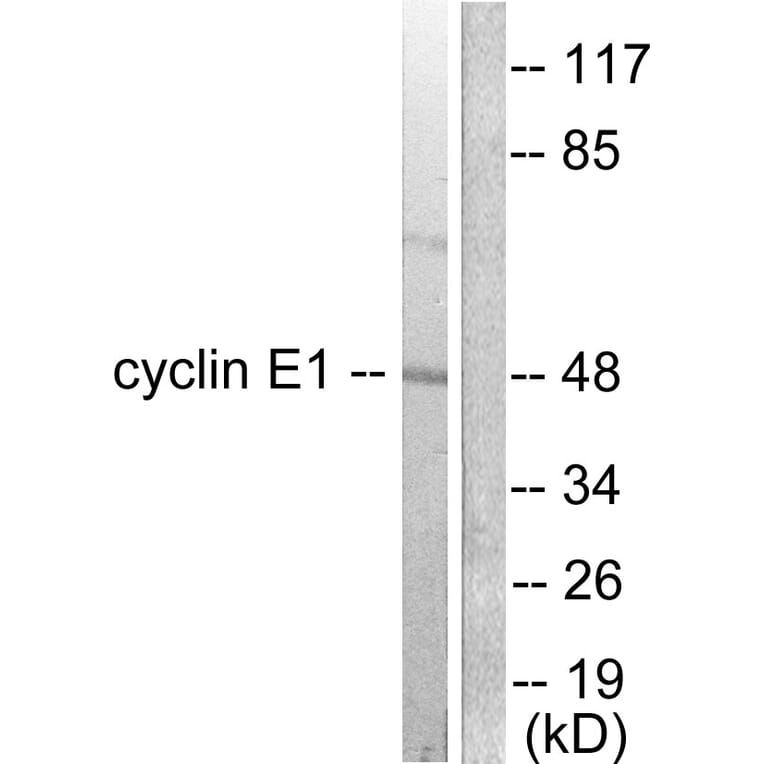 Western Blot - Anti-Cyclin E1 Antibody (C0167) - Antibodies.com