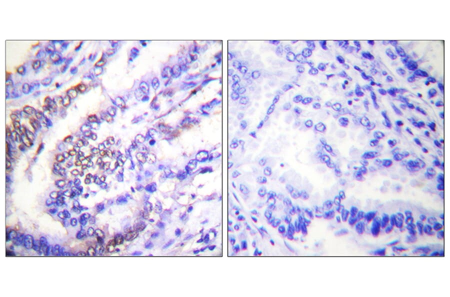 Immunohistochemistry - Anti-Cyclin E1 Antibody (C0167) - Antibodies.com