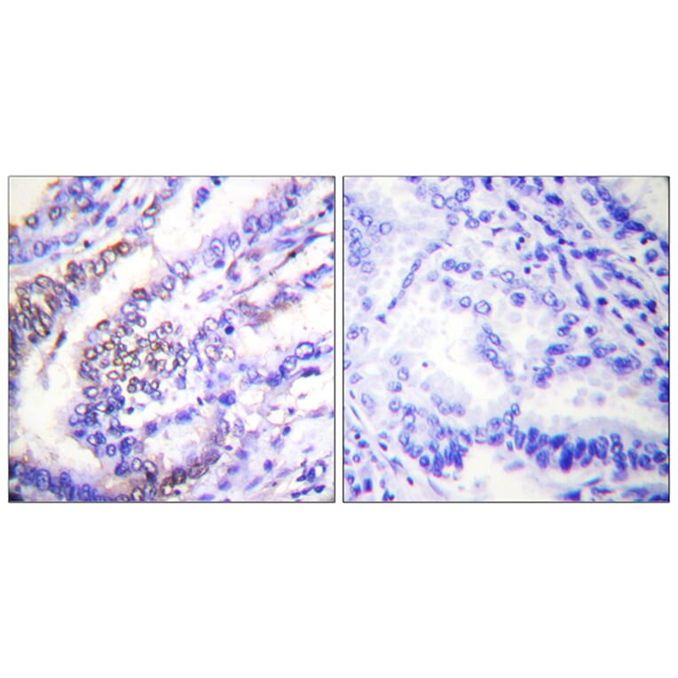 Immunohistochemistry - Anti-Cyclin E1 Antibody (C0167) - Antibodies.com