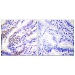 Immunohistochemistry - Anti-Cyclin E1 Antibody (C0167) - Antibodies.com