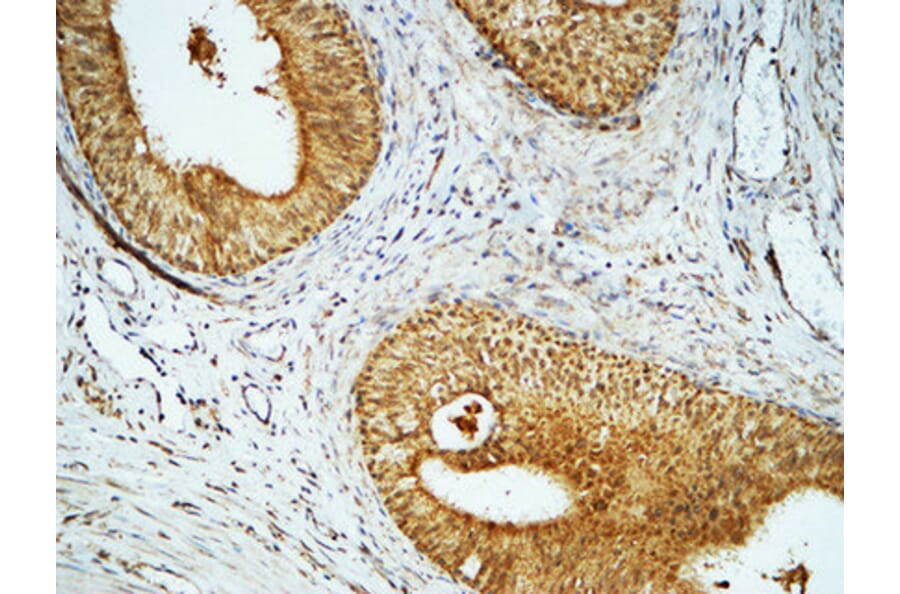 Immunohistochemistry - Anti-Cyclin E1 Antibody (C0167) - Antibodies.com