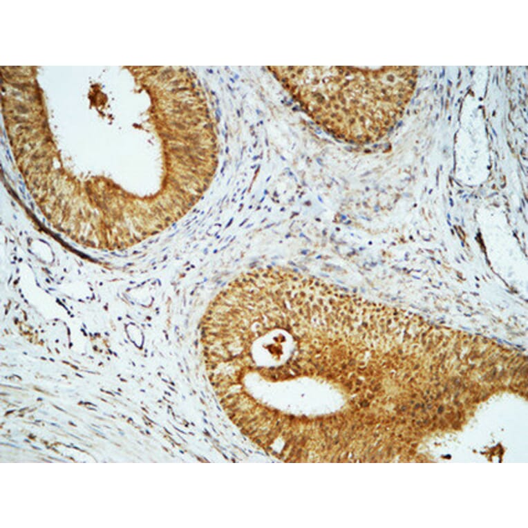 Immunohistochemistry - Anti-Cyclin E1 Antibody (C0167) - Antibodies.com