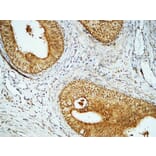 Immunohistochemistry - Anti-Cyclin E1 Antibody (C0167) - Antibodies.com