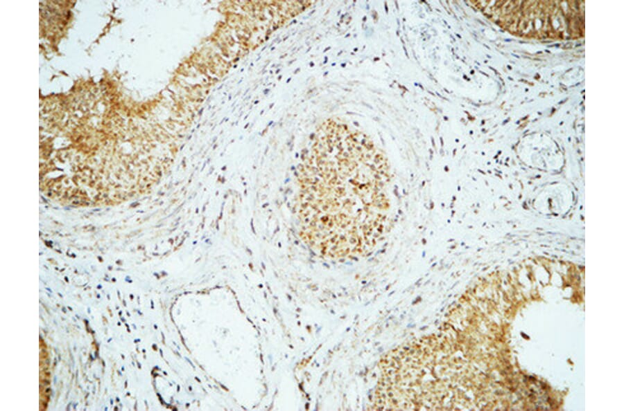 Immunohistochemistry - Anti-Cyclin E1 Antibody (C0167) - Antibodies.com