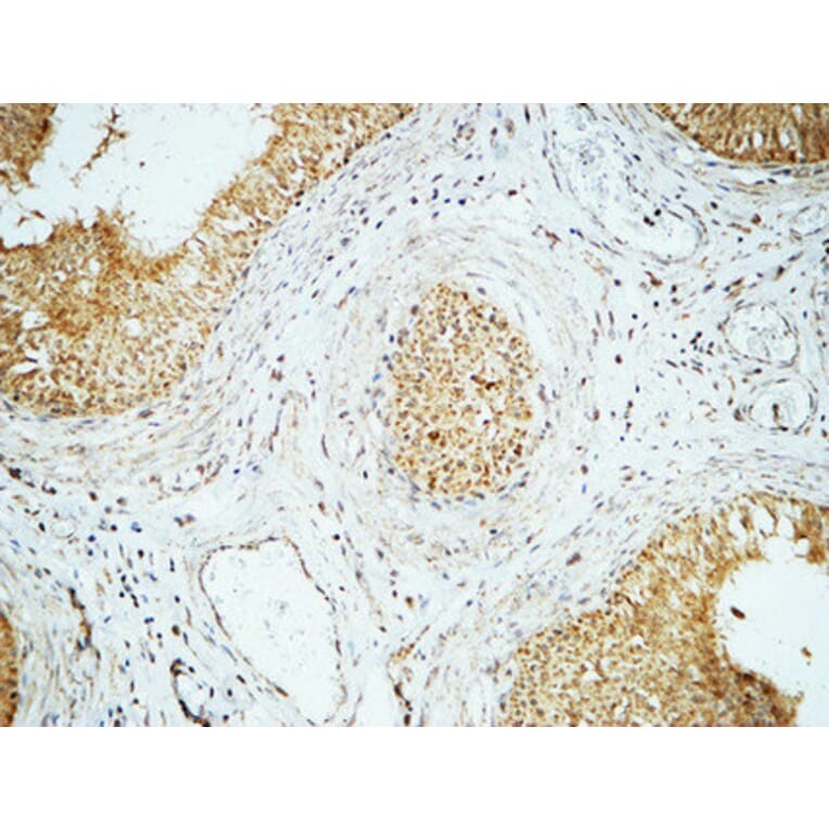 Immunohistochemistry - Anti-Cyclin E1 Antibody (C0167) - Antibodies.com