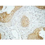 Immunohistochemistry - Anti-Cyclin E1 Antibody (C0167) - Antibodies.com