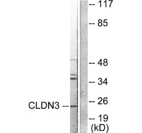 Western Blot - Anti-Claudin 3 Antibody (C0144) - Antibodies.com