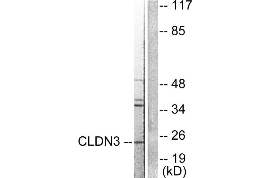 Western Blot - Anti-Claudin 3 Antibody (C0144) - Antibodies.com