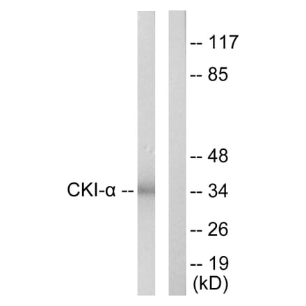 Western Blot - Anti-CKI-alpha Antibody (C10638) - Antibodies.com