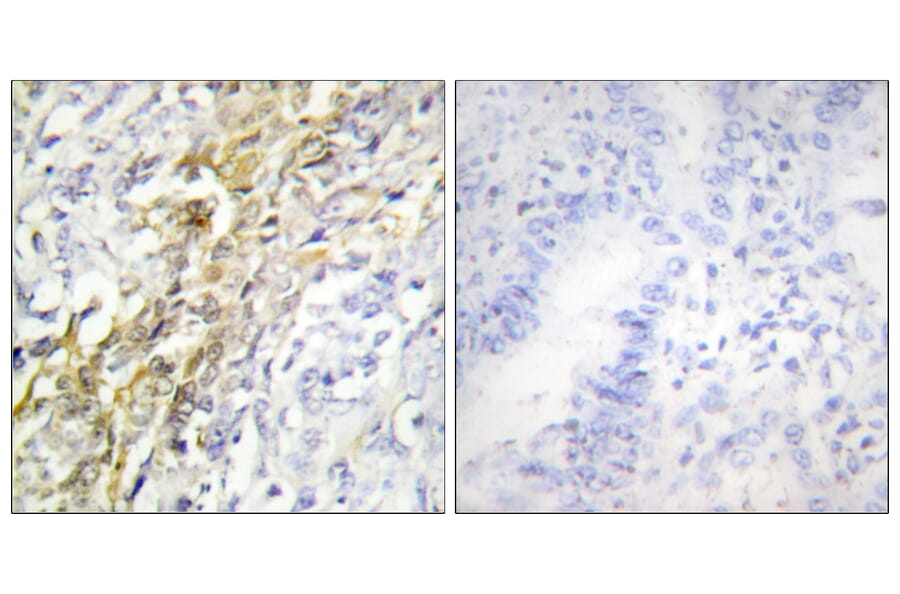 Immunohistochemistry - Anti-CKI-alpha Antibody (C10638) - Antibodies.com