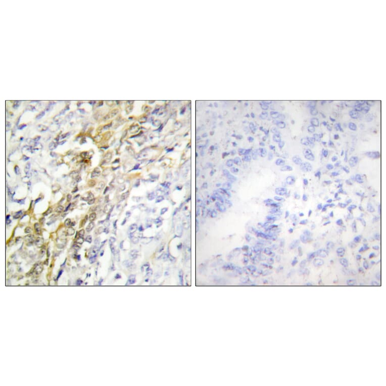 Immunohistochemistry - Anti-CKI-alpha Antibody (C10638) - Antibodies.com