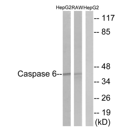 Western Blot - Anti-Caspase 6 Antibody (B0058) - Antibodies.com