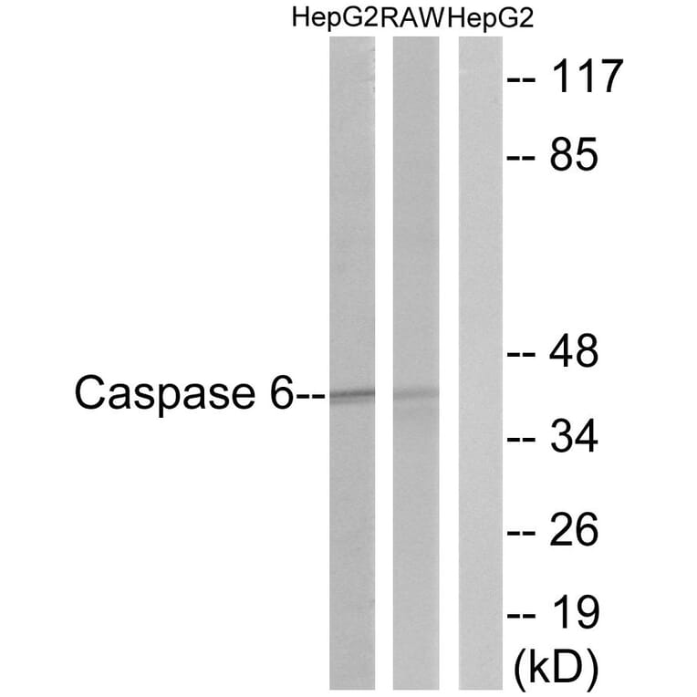 Western Blot - Anti-Caspase 6 Antibody (B0058) - Antibodies.com