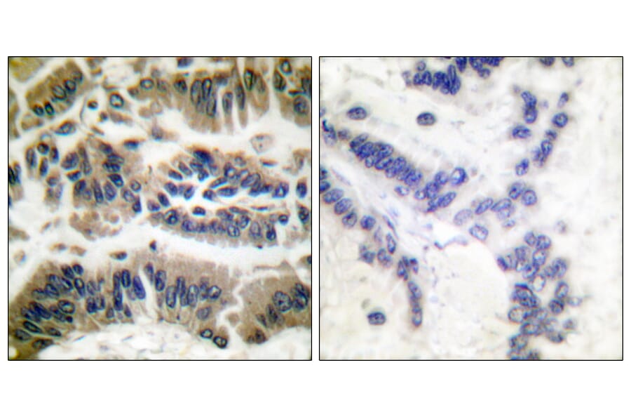 Immunohistochemistry - Anti-Caspase 6 Antibody (B0058) - Antibodies.com