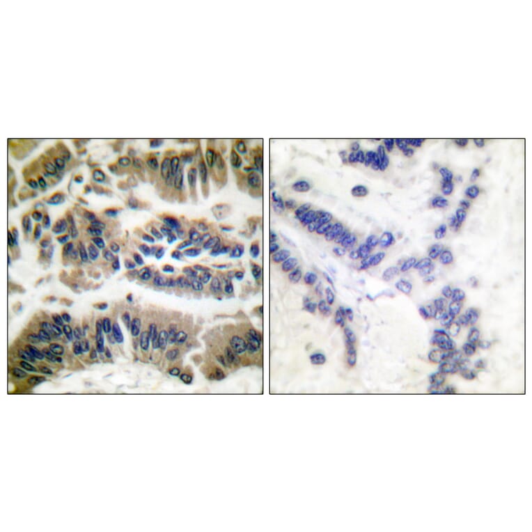 Immunohistochemistry - Anti-Caspase 6 Antibody (B0058) - Antibodies.com