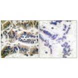 Immunohistochemistry - Anti-Caspase 6 Antibody (B0058) - Antibodies.com