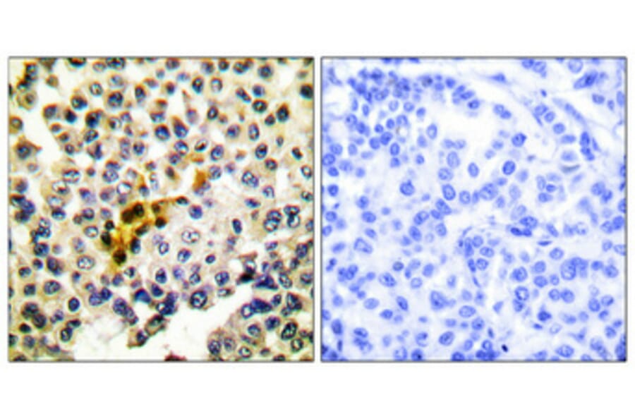 Immunohistochemistry - Anti-Caspase 6 Antibody (B0058) - Antibodies.com