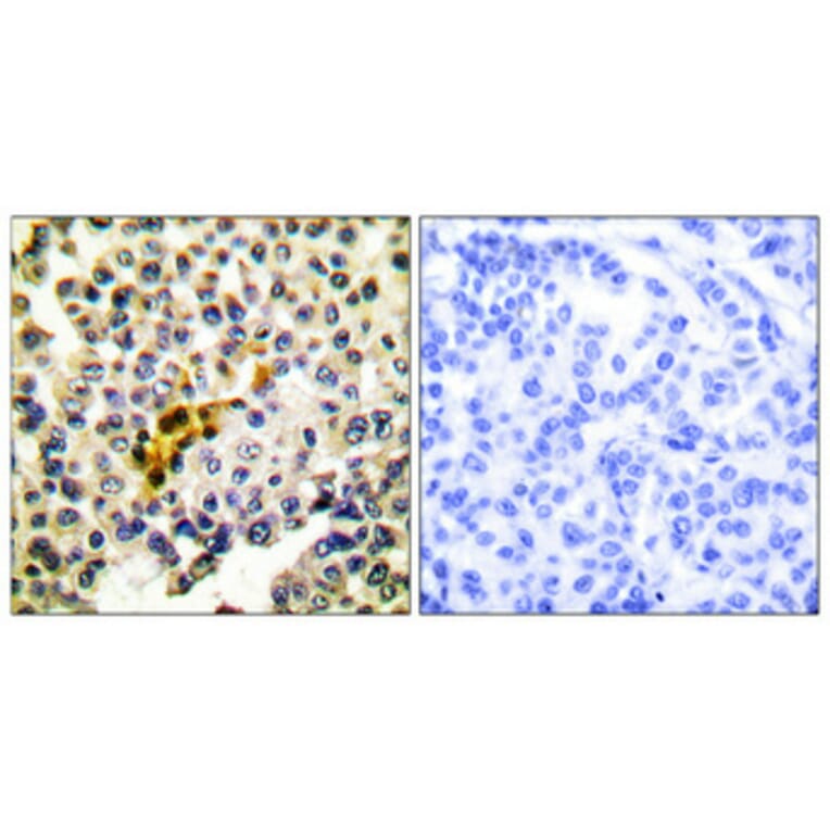 Immunohistochemistry - Anti-Caspase 6 Antibody (B0058) - Antibodies.com