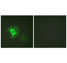 Immunofluorescence - Anti-Caldesmon Antibody (B0462) - Antibodies.com