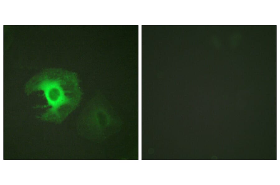Immunofluorescence - Anti-Caldesmon Antibody (B0462) - Antibodies.com
