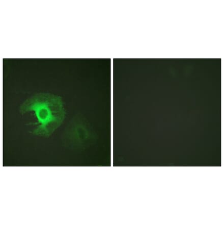Immunofluorescence - Anti-Caldesmon Antibody (B0462) - Antibodies.com