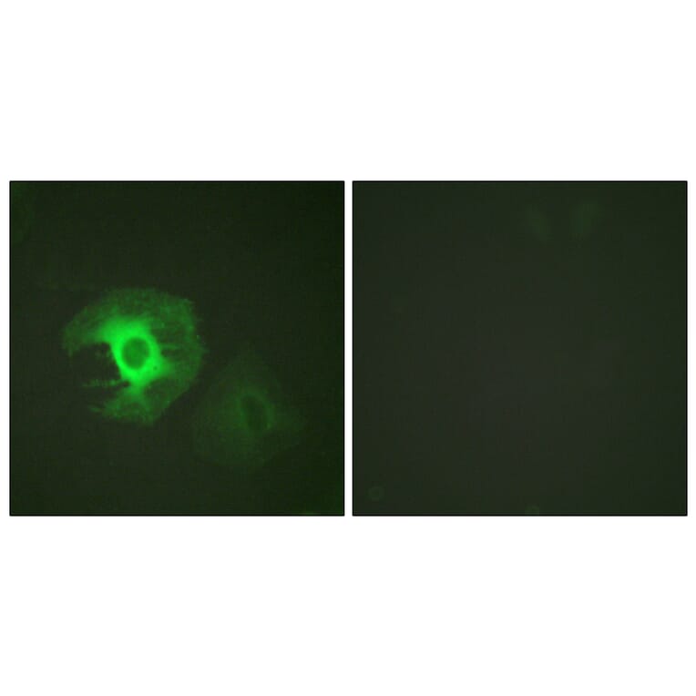 Immunofluorescence - Anti-Caldesmon Antibody (B0462) - Antibodies.com