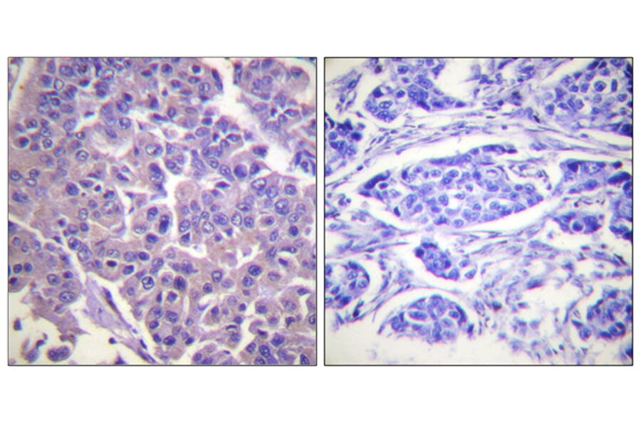 Immunohistochemistry - Anti-Caldesmon Antibody (B0462) - Antibodies.com