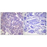 Immunohistochemistry - Anti-Caldesmon Antibody (B0462) - Antibodies.com