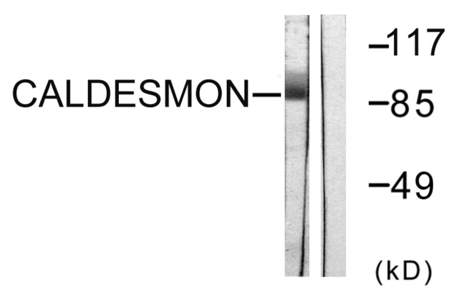 Western Blot - Anti-Caldesmon Antibody (B0462) - Antibodies.com
