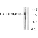 Western Blot - Anti-Caldesmon Antibody (B0462) - Antibodies.com
