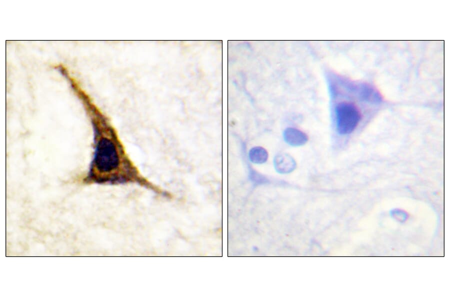 Immunohistochemistry - Anti-Adrenergic Receptor B2 (phospho Ser355+Ser356) Antibody (A0764) - Antibodies.com