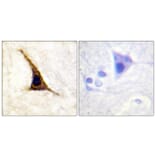 Immunohistochemistry - Anti-Adrenergic Receptor B2 (phospho Ser355+Ser356) Antibody (A0764) - Antibodies.com