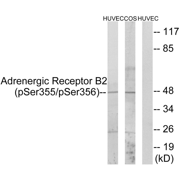 Western Blot - Anti-Adrenergic Receptor B2 (phospho Ser355+Ser356) Antibody (A0764) - Antibodies.com