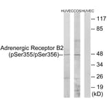 Western Blot - Anti-Adrenergic Receptor B2 (phospho Ser355+Ser356) Antibody (A0764) - Antibodies.com